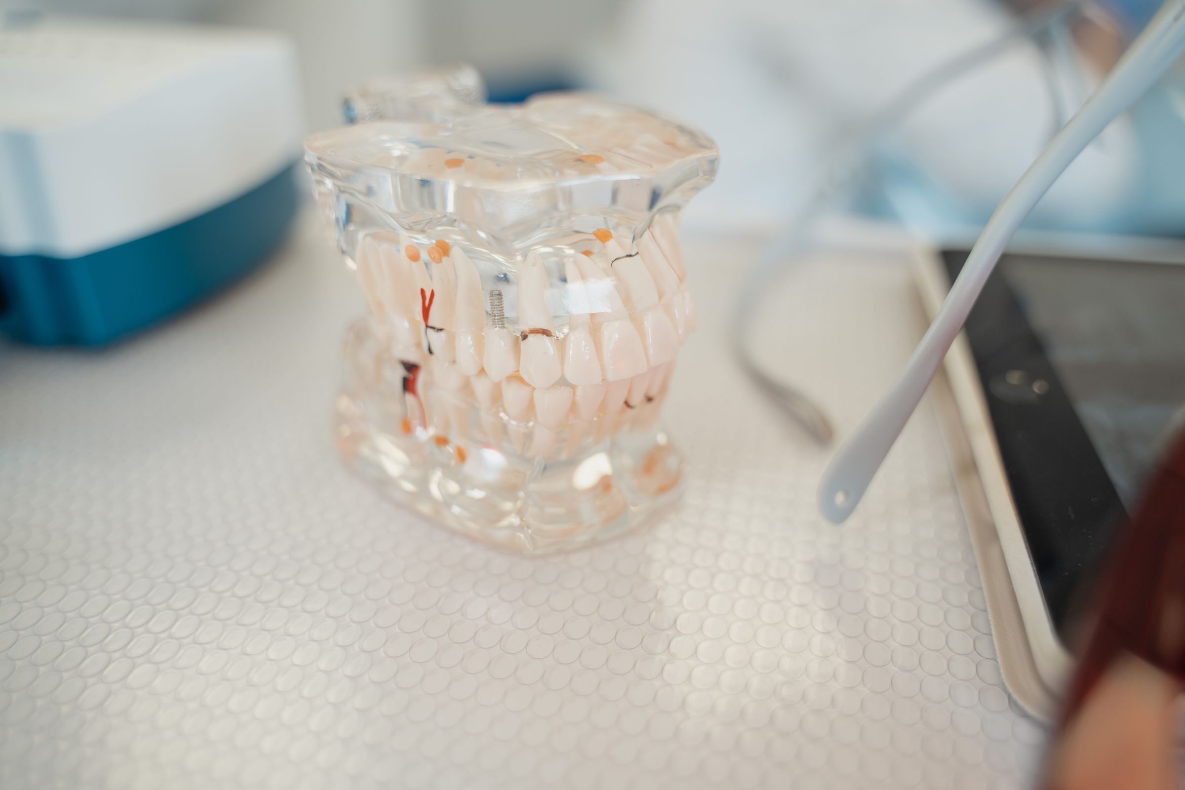 Clear Aligners